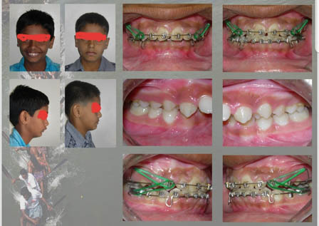 Dentist in ahmednagar